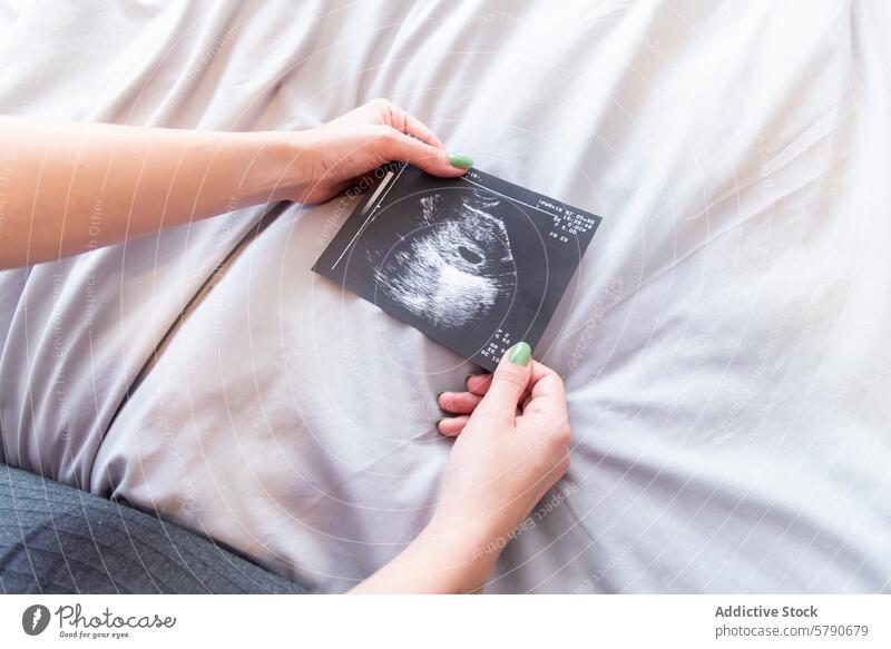 Werdende Mutter hält Sonogramm auf ihrem Bauch Schwangerschaft Ultraschall Mutterschaft erwartungsvoll Frau pränatal Reise Vorfreude Baby Elternschaft Freude