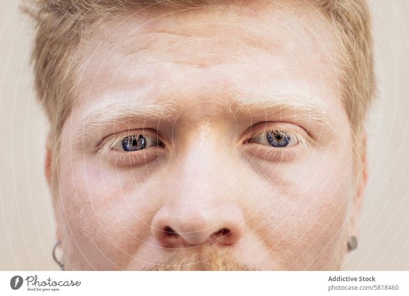 Nahaufnahme eines Albino-Latino-Mannes weiß männlich Typ blond Gesicht Person jung Behaarung Erwachsener gutaussehend Albinismus Haut Lifestyle Ausdruck